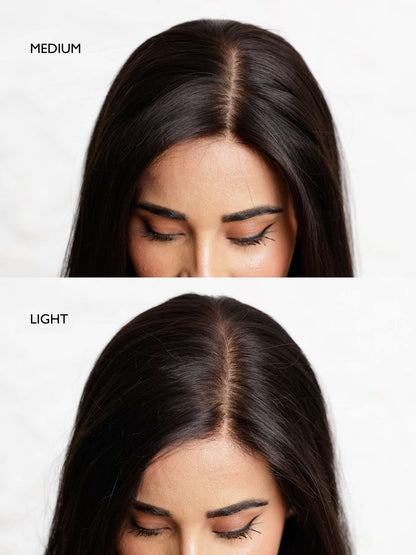 🔥Last Day:60% Off🔥Hybrid Hairline Topper